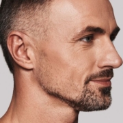 Rimodellamento jawline con ultrasuoni microfocalizzati ecoguidati Rimodellamento jawline con ultrasuoni microfocalizzati ecoguidati